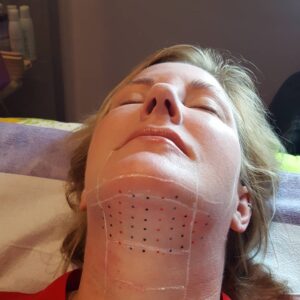 double chin treatment