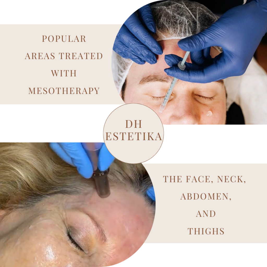 Popular Areas Treated with Mesotherapy in Boston