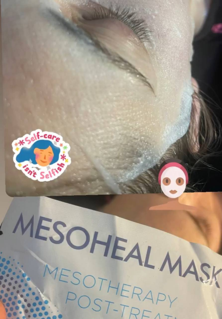 mesotherapy - dh estetika salon - mesoheal mask